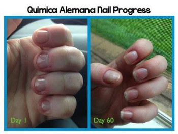 Quimica Alemana - 0.47oz Quimica Alemana - 0.47oz