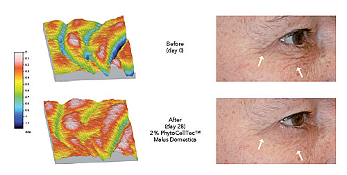 apple stem cells effect on crows feet