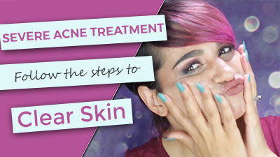 Severe Acne Treatment Kit