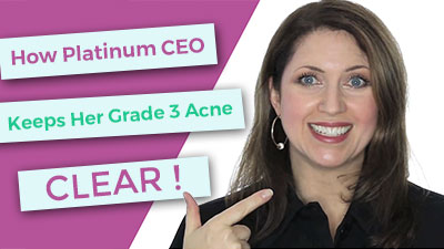 How Platinum CEO Keeps her grade 3 acne clear