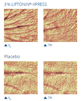 Liftonin(R)-Xpress smoothes wrinkles