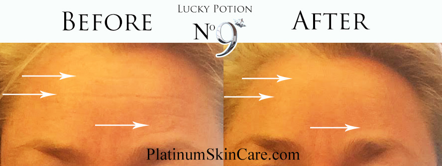 Lucky Potion No. 9 - Instant Skin Tightening Cream