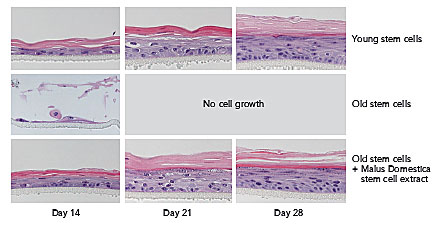 Skin stem cells young versus old