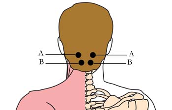 tachyon-product-os-15-headache-migrane-cell-points1.jpg