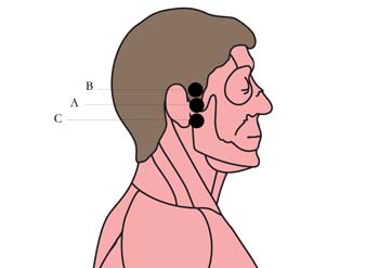 tachyon-product-os-16-ear-pain-cell-points-.jpg