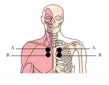 tachyon-product-os-8-bronchial-asthma-cell-points.jpg