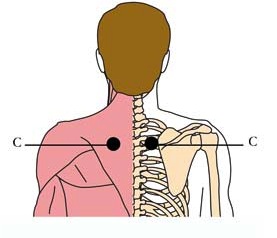 tachyon-products-os-8-bronchial-asthma-cell-points2.jpg