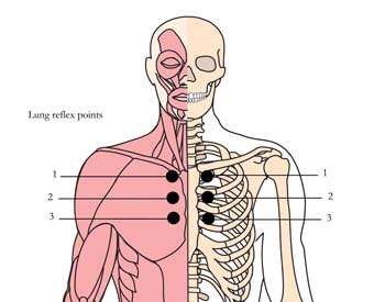 tachyon-products-os-8-bronchial-asthma-tlc-points.jpg