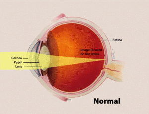 Normal Eye