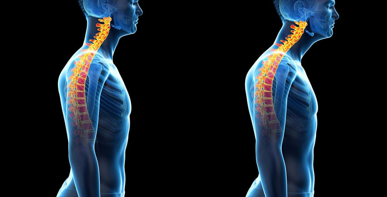 7 Ways to Improve Posture Backed by Science (Infographic)