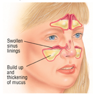 Oral Antihistamines