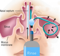 Oral Antihistamines