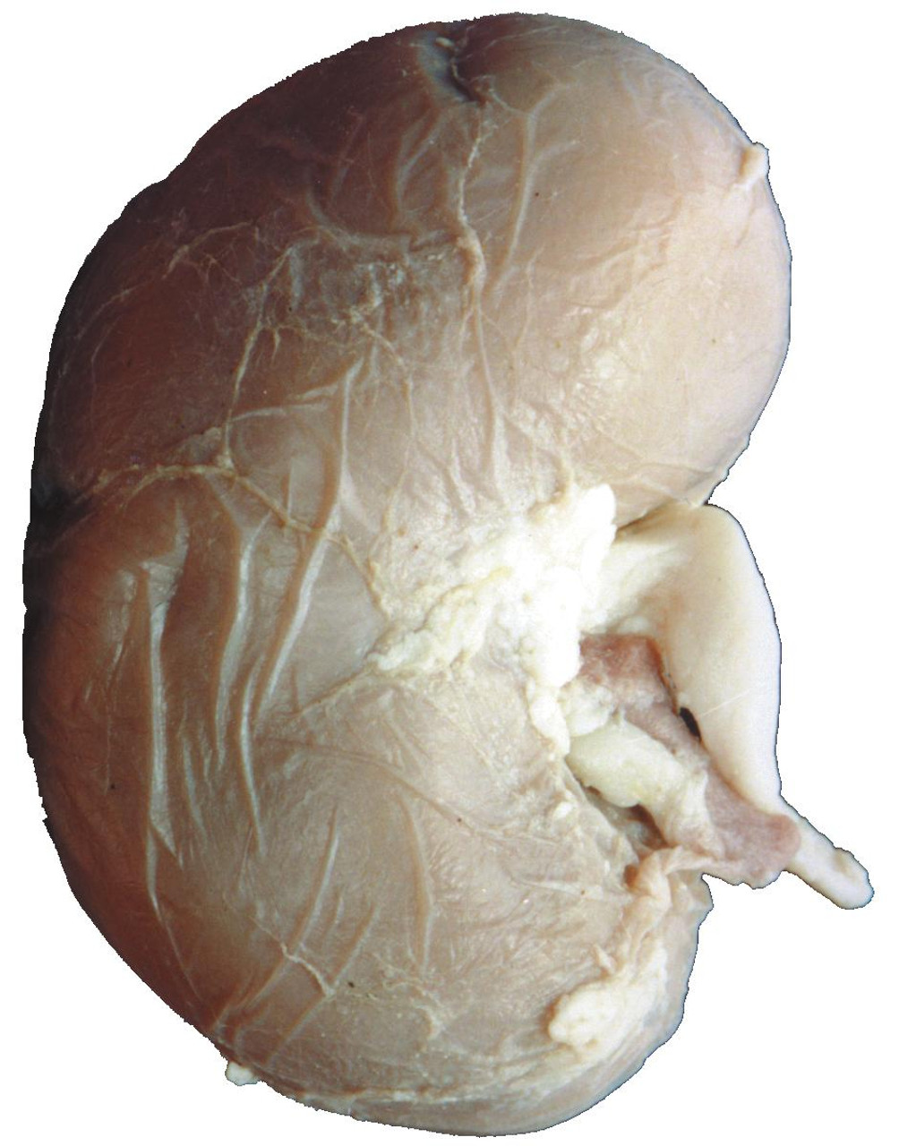 Sheep Kidney Dissection Specimen | Learn Human Anatomy