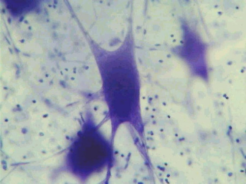 Neuron slide, motor, smear