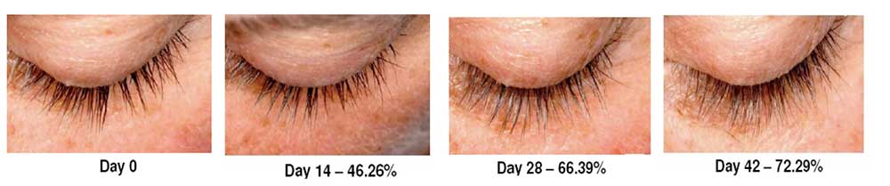 Eyelash growth